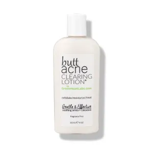 Butt Acne Clearing Lotion ® | 4 oz (113 gr)