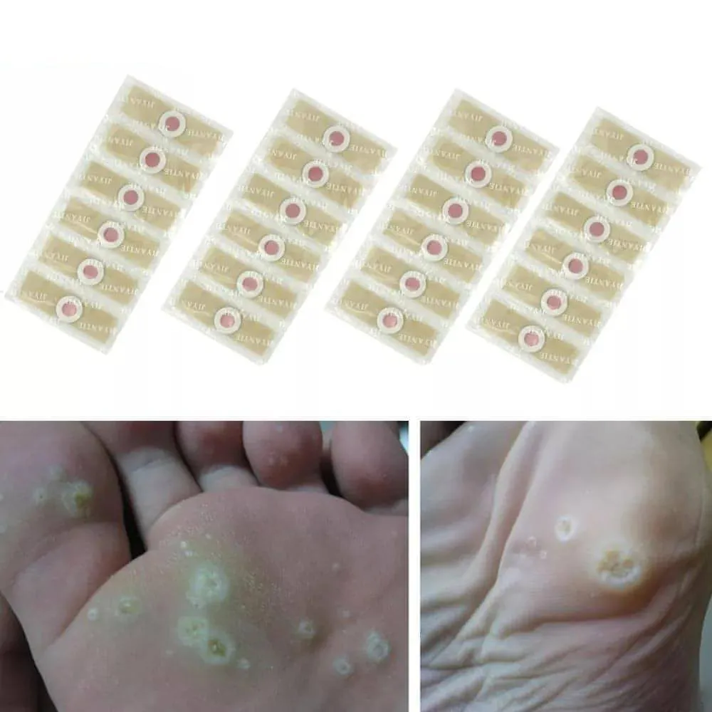 Corn Remover Pads | Remove Foot Corns Fast, Protection Against Shoe Pressure