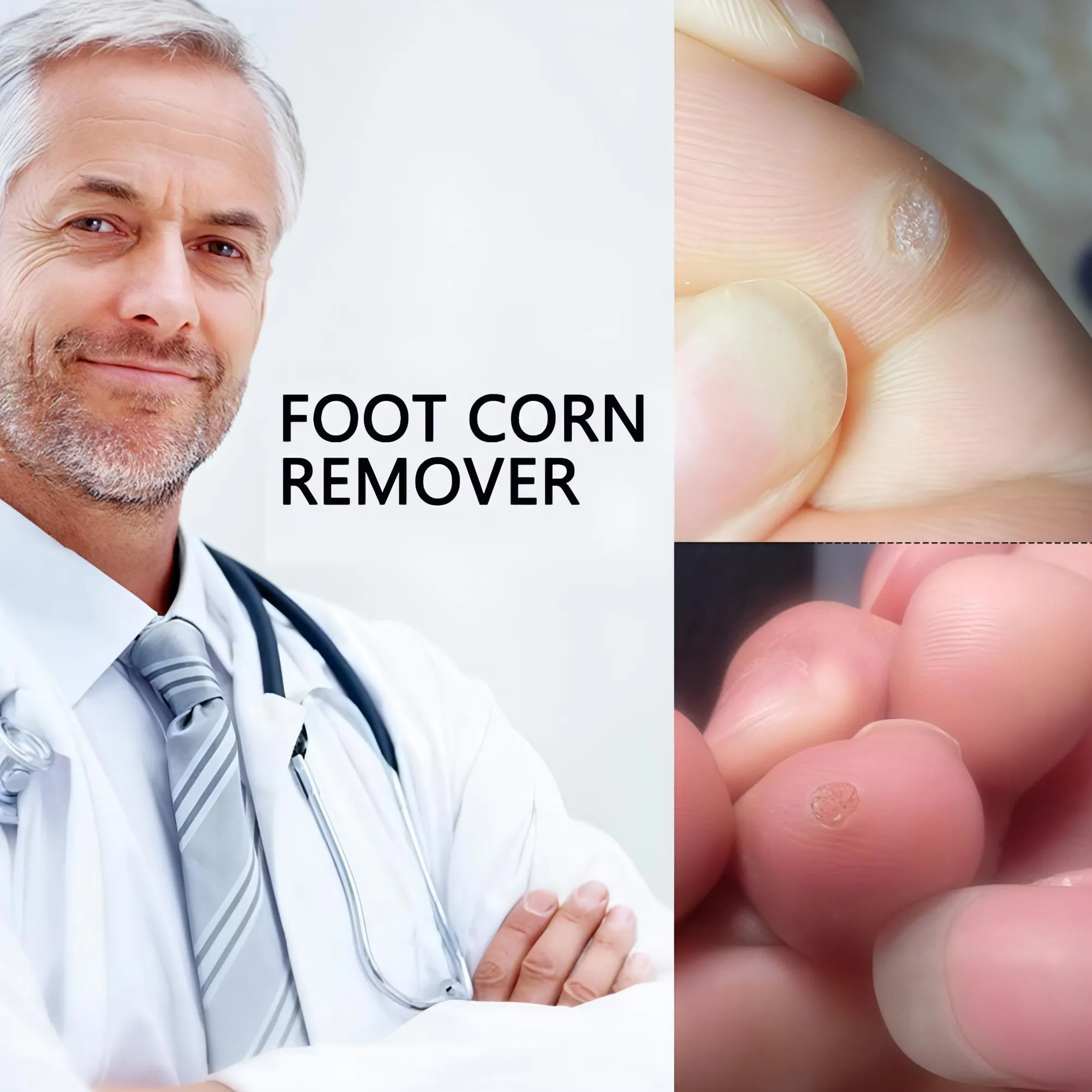 Corn Remover Pads | Remove Foot Corns Fast, Protection Against Shoe Pressure